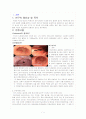위염 케이스 (gastritis case ) 1페이지