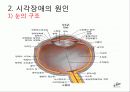 시각장애아의 교육 3페이지