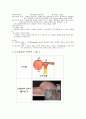 월경장애에 대하여 9페이지