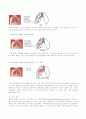 lobectomy 8페이지