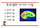 측두엽의 기능과 측두엽 손상에 따른 문제점 3페이지