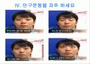 백내장ppt  노화와 건강 31페이지