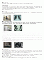 폐암, lung ca. 간호진단 간호과정 문헌고찰 6페이지