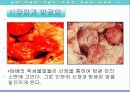 담배와 흡연 61페이지