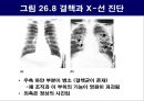 공기매개 병원균, 호흡기 질병 원인균 38페이지