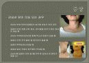 Thyroid gand(갑상선 암)관련 PPT자료입니다. 참고하세요 16페이지