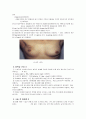 유방암 문헌고찰 and 간호사정 (사진포함) 15페이지