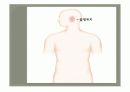 만성중이염 문헌고찰/간호사정 ppt ♥ 5페이지
