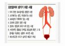 요로결석 문헌고찰/간호사정 ppt ♥ 4페이지