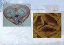 순환기계 (Cardiovascular system) 15페이지