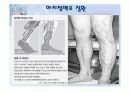 뇌 심혈관계 질환 64페이지