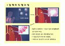 결핵(Tuberculosis)의 이해  3페이지