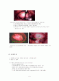 모성간호학-실습 케이스 자궁근종(Uterine myoma) 5페이지