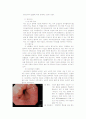 역류성식도염 컨퍼런스 자료 3페이지