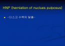 척추질환에 따른 영상의학 영상 18페이지