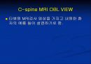 척추질환에 따른 영상의학 영상 55페이지