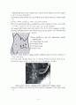수술실 case study (Laparoscopic Parcial Nephrectomy) 14페이지