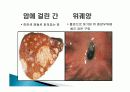 흡연과 건강 26페이지