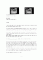 자궁내막암 Endometrial Cancer  7페이지