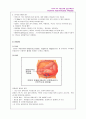 Congenital megacolon (선천성거대결장) 11페이지