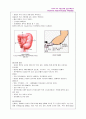 Congenital megacolon (선천성거대결장) 12페이지