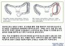 선천성 거대결장 13페이지