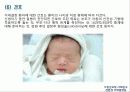 선천성 거대결장 16페이지