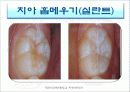 구강보건교육 19페이지