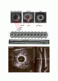 IVUS ( Intravascular Ultrasound ) 4페이지