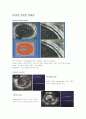 IVUS ( Intravascular Ultrasound ) 5페이지