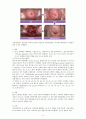 자궁경부암 2페이지