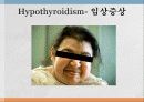 갑상선 질환, 갑상신기능항진증과 저하증  12페이지