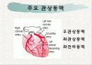 심근경색증 파워포인트 2페이지