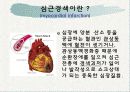 심근경색증 파워포인트 3페이지