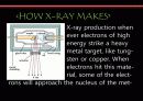 x-ray 엑스레이  9페이지