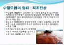 수질오염에 대한 발표자료 15페이지