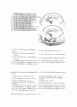 (간호학) 뇌동맥류환자 간호 aneurysm 5페이지