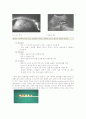 방광결석 문헌고찰 3페이지