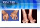 관절염예방과운동방법 20페이지
