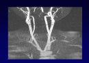ankle joint MRI 5페이지
