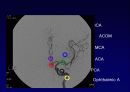 ankle joint MRI 7페이지