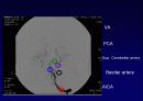 ankle joint MRI 14페이지