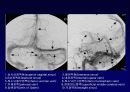 ankle joint MRI 16페이지