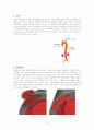 대동맥 박리 aortic dissection 5페이지