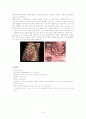 대동맥 박리 aortic dissection 6페이지