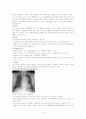 대동맥 박리 aortic dissection 9페이지