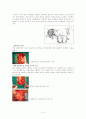 대동맥 박리 aortic dissection 14페이지
