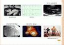 심근경색( Myocardial Infarction. MI ) CASE 19페이지