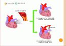 심근경색( Myocardial Infarction. MI ) CASE 25페이지