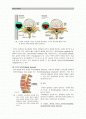 성인간호 척추협착증 case (spinal stenosis) 2페이지